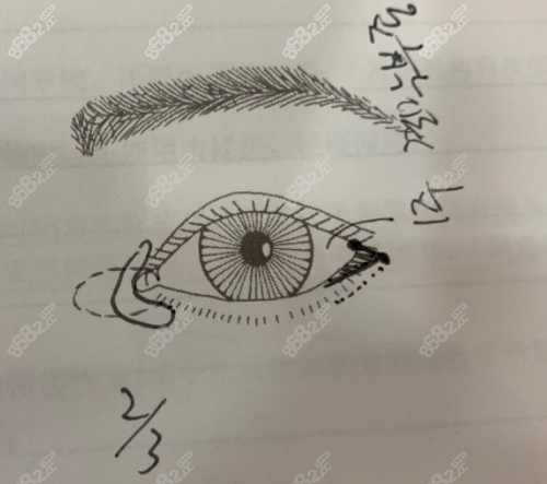 韩国eve修复眼角画示意图