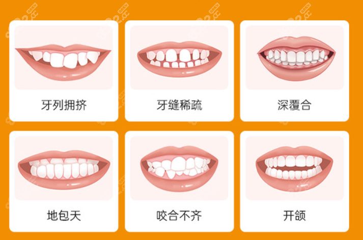 合肥美奥口腔矫正牙齿好的医生
