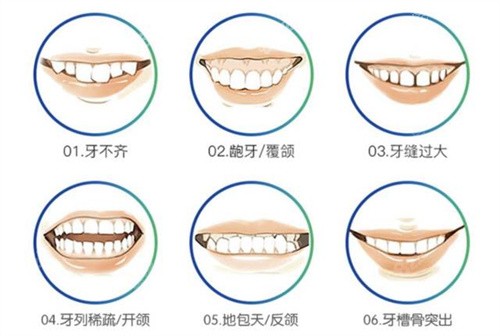 牙齿矫正