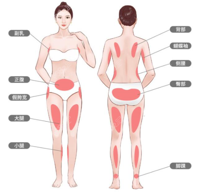 威塑吸脂价格部位