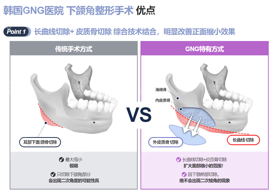 图1-44 下颌骨(前面观)-基础医学-医学