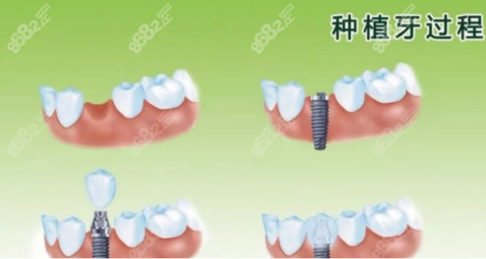 成都新桥口腔医院
