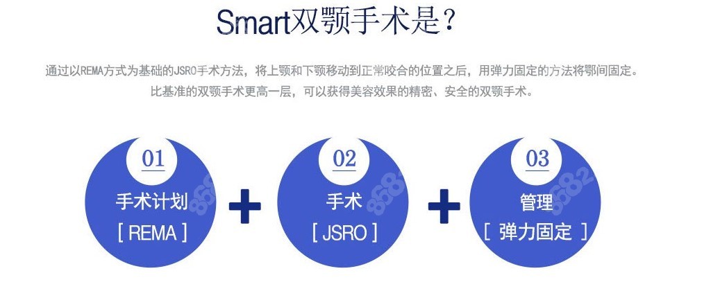 韓國(guó)雙鄂手術(shù)新技術(shù)：smart雙鄂手術(shù) 8682.cc分享