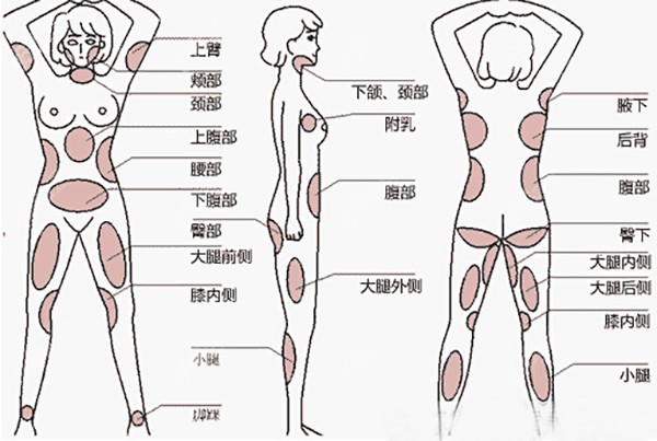 抽脂5000ml脂肪等于多少斤