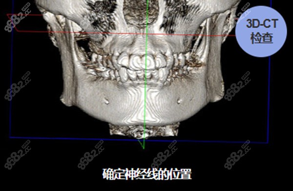 韩国GNG医院术前检查充分8682.cc