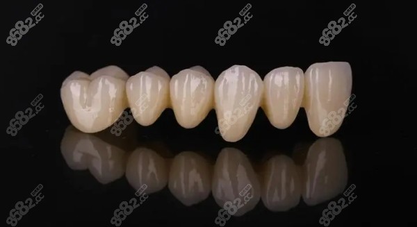 南昌镶全瓷牙价格