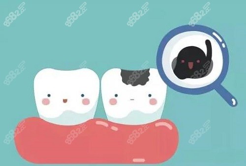 根管治疗后牙齿能用一辈子吗
