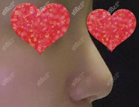 手術(shù)后的真實照片