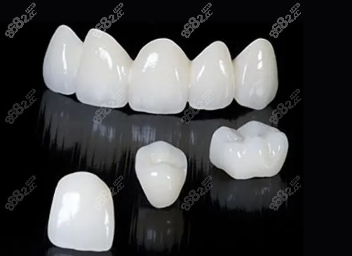 合肥全瓷牙价格m.8682.cc