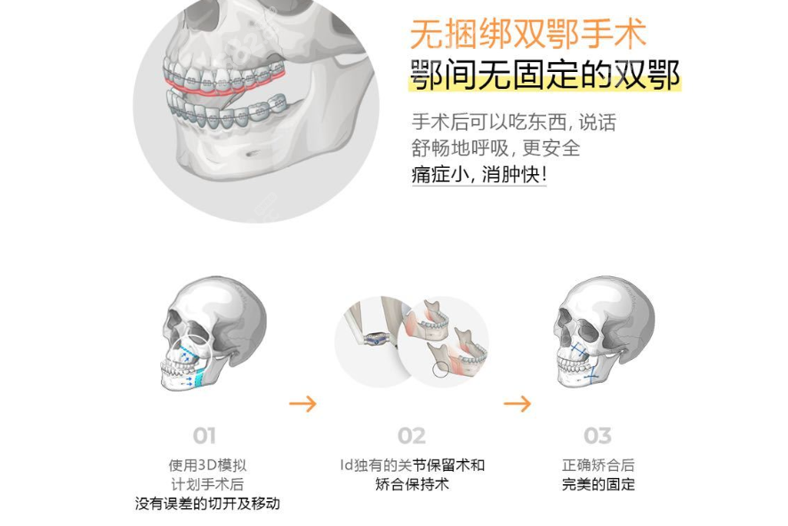 8682.cc朴相薰亲自手术费用