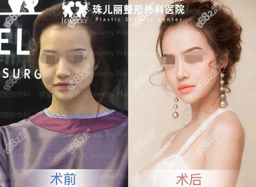 韩国珠儿丽整形外科