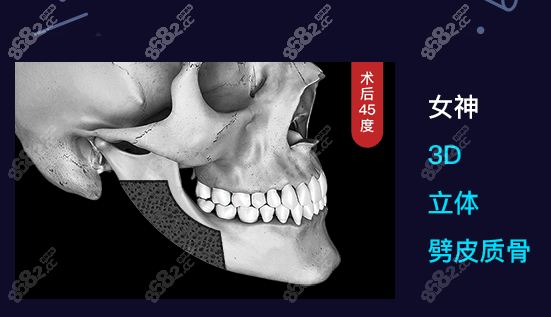 韩国女神整形外科轮廓磨骨好不好