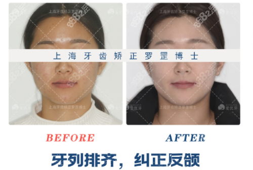 罗罡牙医正畸