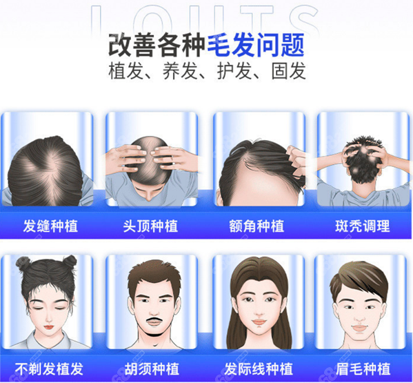碧莲盛植发多少钱一个单位