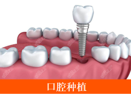 上海薇琳口腔种植牙