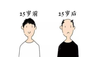 明星为什么不植发