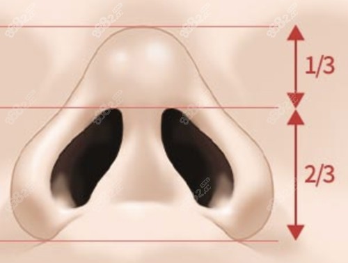 鼻孔矫正的方法有哪些？