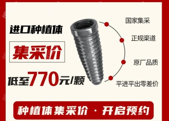 厦门麦芽口腔韩国登腾种植牙价格770元起