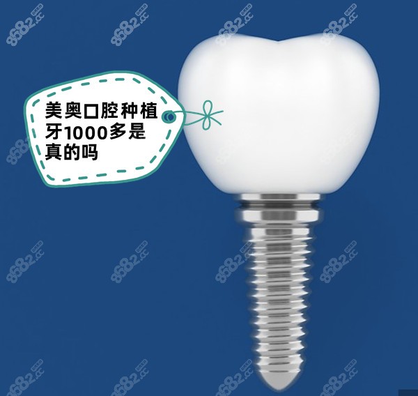 美奥口腔种植牙1000多是真的吗