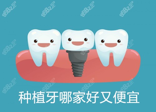 种植牙哪家医院好又便宜