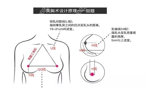 杭州时光隆胸