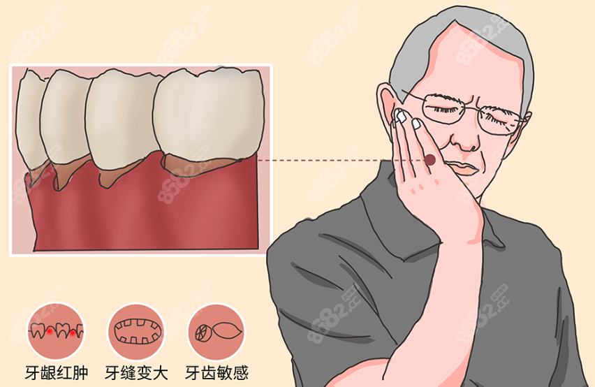 牙齿萎缩治疗方式到底有几种