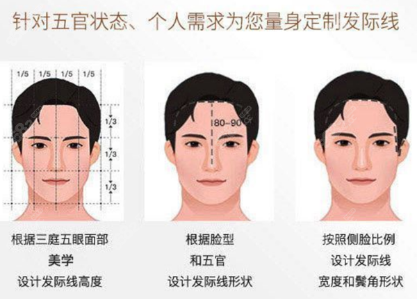 百年植发个性化设计种植