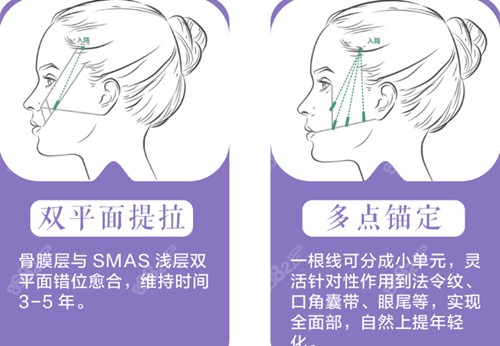 谭永嘉面部提升技术优势介绍