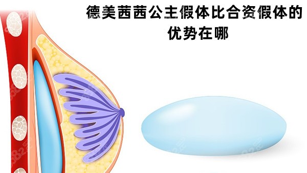 德美茜茜公主假体比合资假体的优势在哪