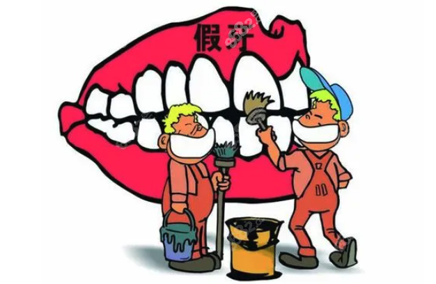 活动义齿多少钱一副