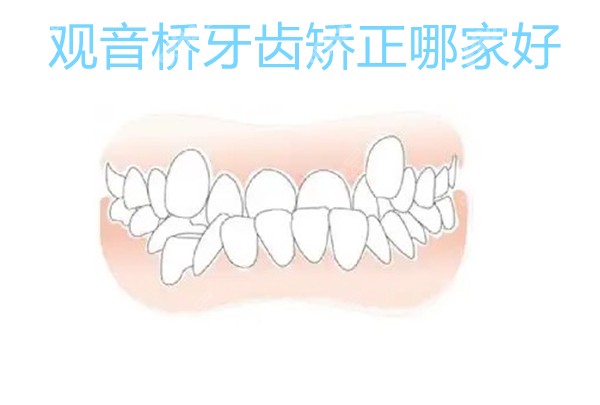 观音桥牙齿矫正哪家好