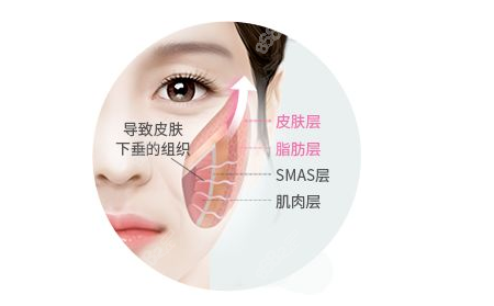 筋膜提升层次
