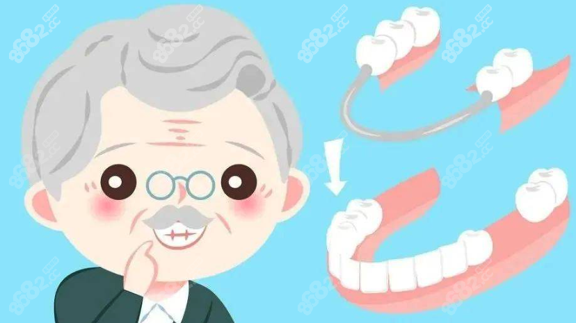 无挂钩活动义齿优缺点是什么