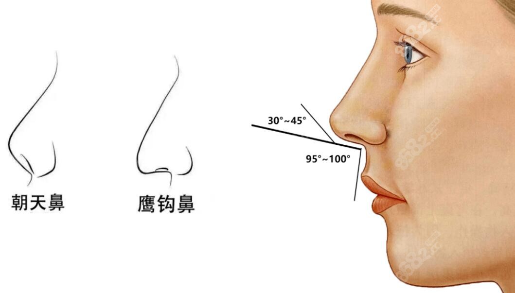 鼻子的标准夹角