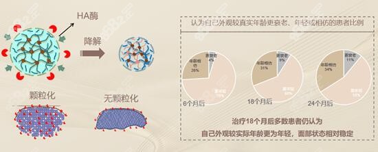芙妮薇尊雅玻尿酸适合注射哪里m.8682.cc