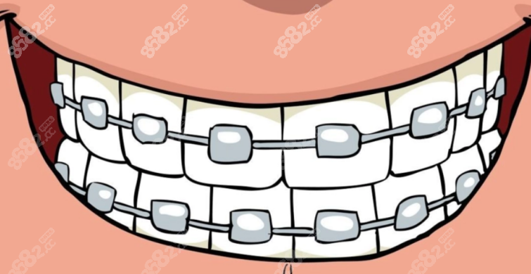 牙齿矫正手术