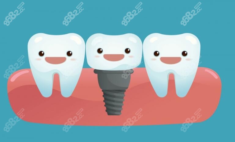 单颗牙齿动画图www.8682.cc