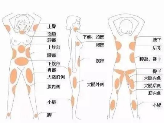 唐山市哪个医院做减肥吸脂手术好