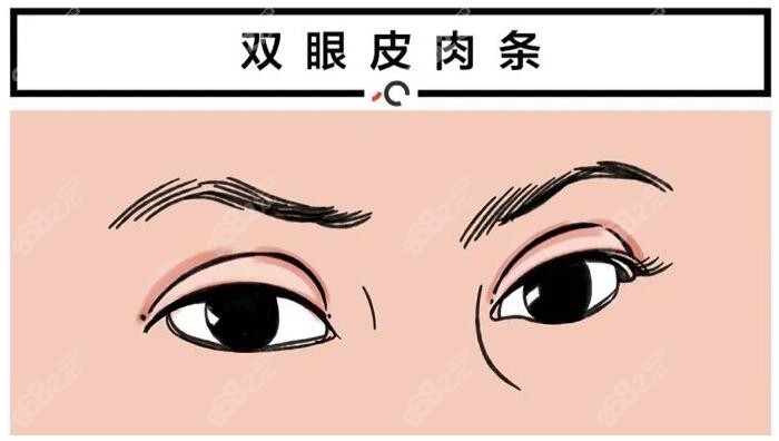 董开云是重庆双眼皮修复口碑好的医生m.8682.cc