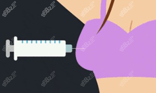 吸脂手术