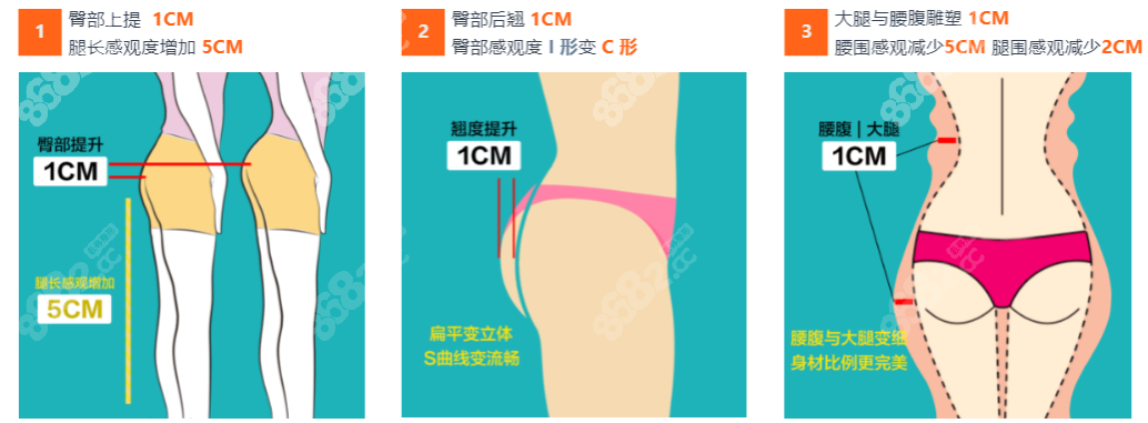 北京禾美嘉吸脂前后对比图8682.cc