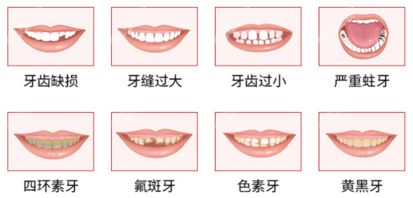 全瓷牙冠可以改善哪些问题 8682.cc