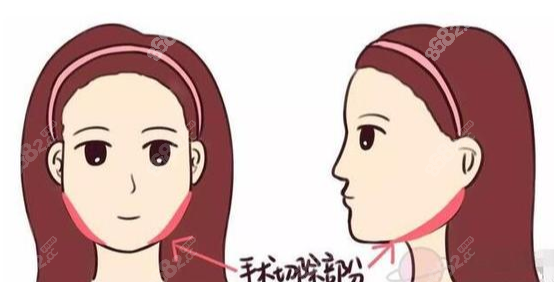 8682.cc韩国玛博尔整形好还是必妩整形好？