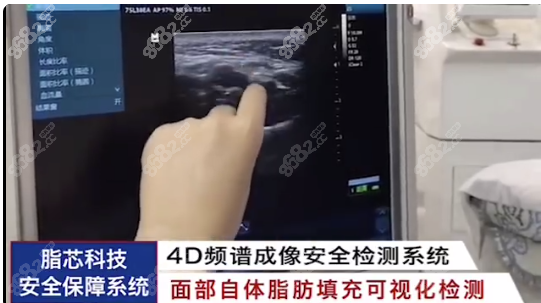 乔爱军脂肪修复术前检查