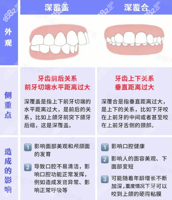 深覆合和深覆盖的区别图解8682.cc