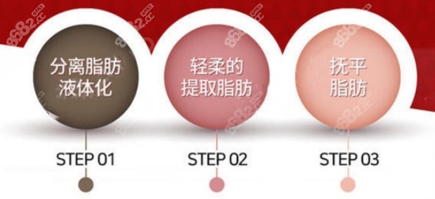 3step safe lipo吸脂新技术