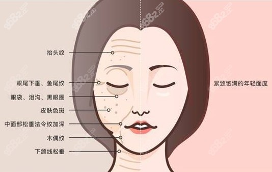 王志军拉皮除皱部位图解m.8/68&2.cc