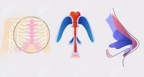 武汉邓斐隆鼻实例图