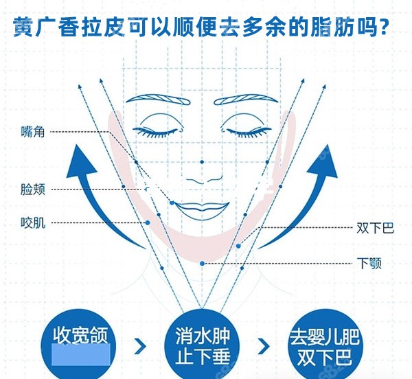 黄广香拉皮可以顺便去多余的脂肪吗