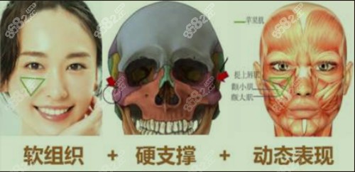 颧韧带及筋膜内外提升固定更持久